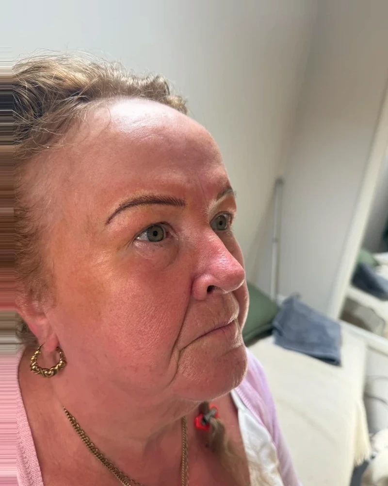 After semi-permanent eyebrow tattoo treatment